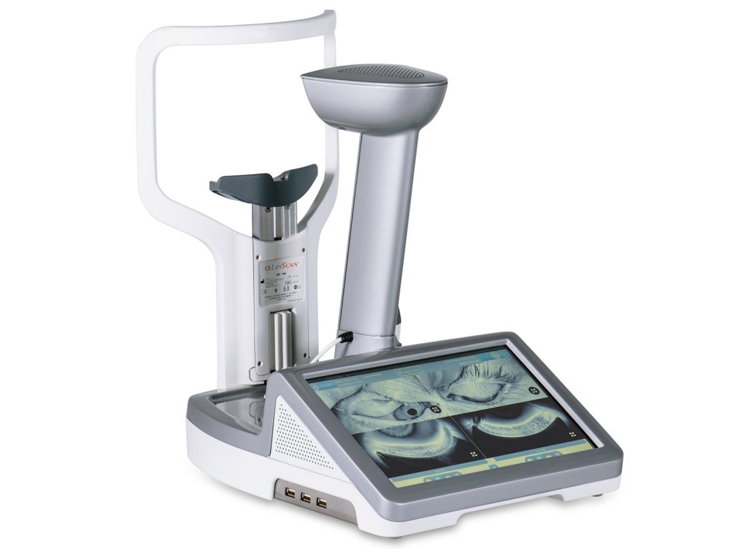 Lipiscan imaging of eyelid glands at Oakville clinic for advanced dry eye diagnosis